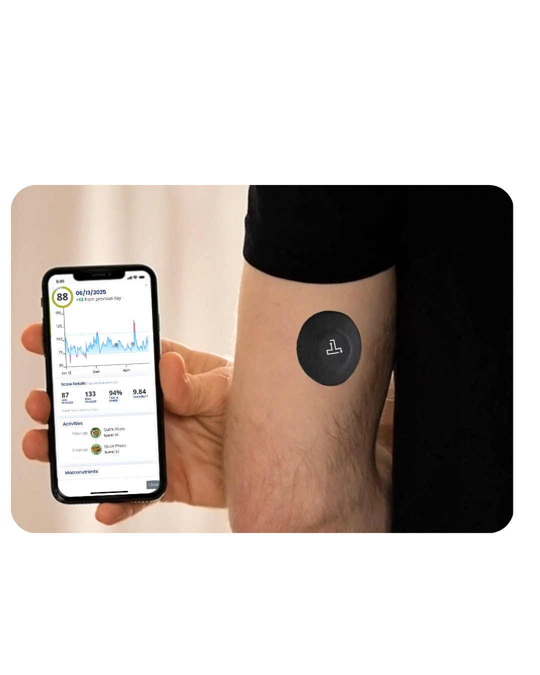 Continuous Glucose Monitor